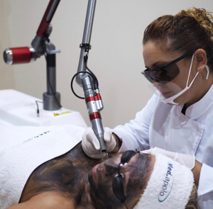 Q-Switched Nd Yag Laser System